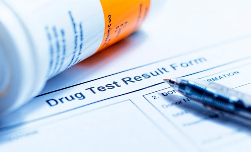 Drug Test Result form