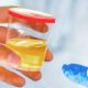 how much urine do you need for a urine drug test