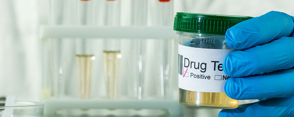 10 Panel Urine Drug Test with Expanded Opiate