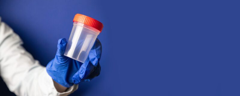 What Does an 8 Panel Drug Test Test For? Comprehensive Guide